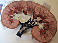 Алкогольная нефропатия Алкогольная нефропатия