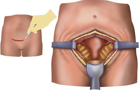 Лечебные мероприятия