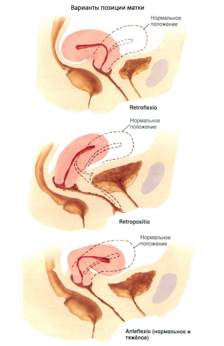 Отличие от ретрофлексии