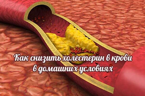 Сосуды забитые холестерином Как снизить холестерин