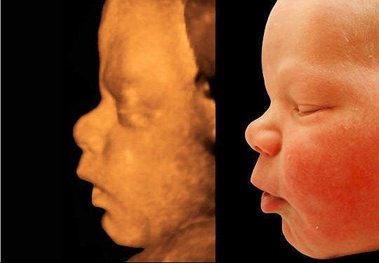 novost_4.jpg novost_4.jpg