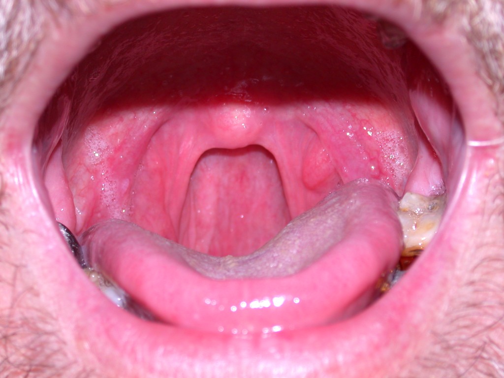 cb457c79821d060a2db916a0aac25a81.jpg cb457c79821d060a2db916a0aac25a81.jpg