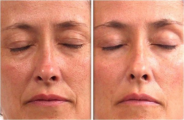 121217_41.jpg 121217_41.jpg