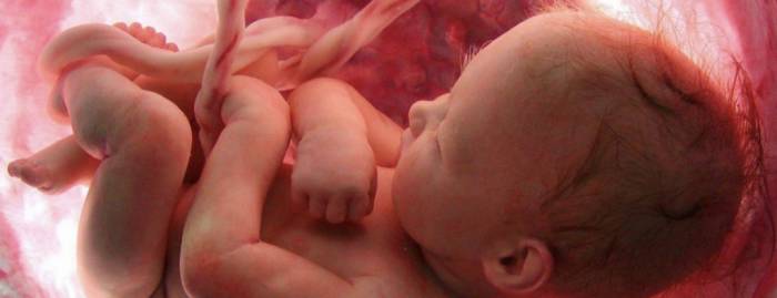Что такое замершая беременность - Что такое замершая беременность