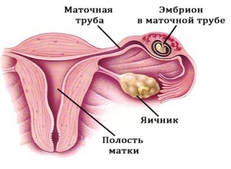 998756.jpg 998756.jpg