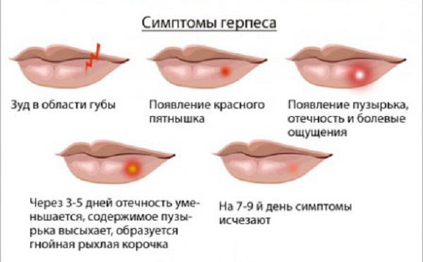 101117_image053.jpg 101117_image053.jpg
