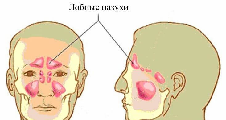 Лобные пазухи