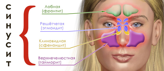 Виды болезни