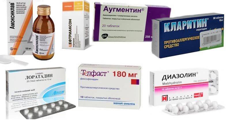 Лекарства от синусита