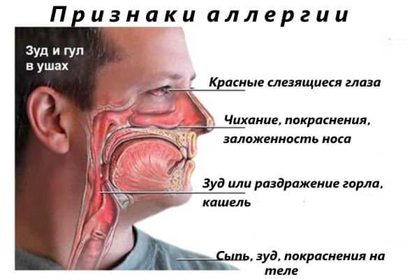 Симптомы аллергии Слезятся глаза при аллергии